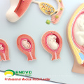 ANATOMY15 (12453) Modelo de Processo de Desenvolvimento Embrionário, Desenvolvimento do Ovum Não Fertilizado para o 9º Mês